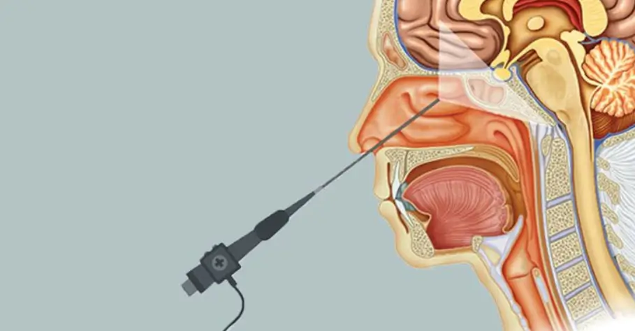 Skull Base Surgery 1 skull base surgery Dr Anutosh Singh Neurosurgeon 1
